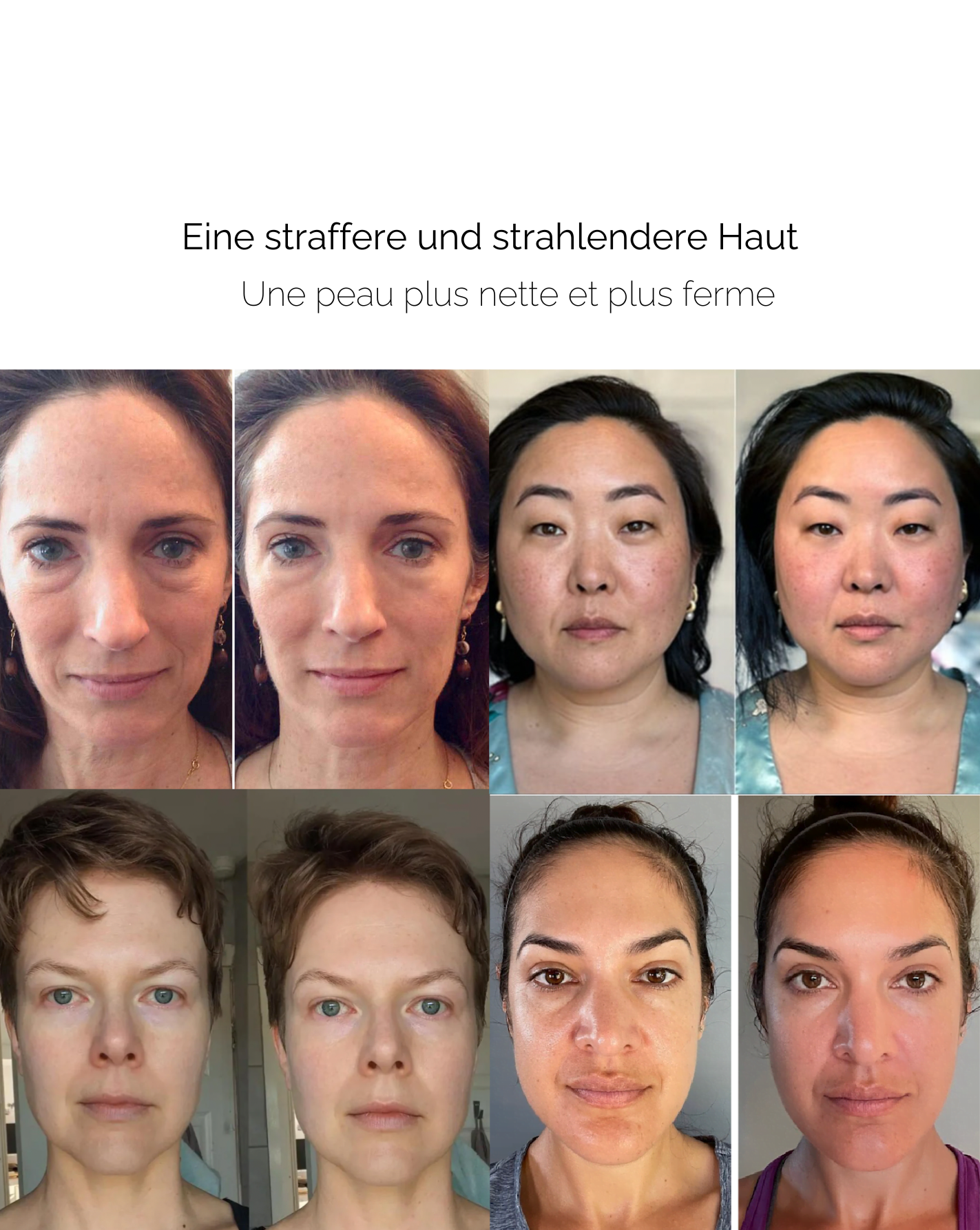 The skin rejuvenation roller – reduces wrinkles and puffiness