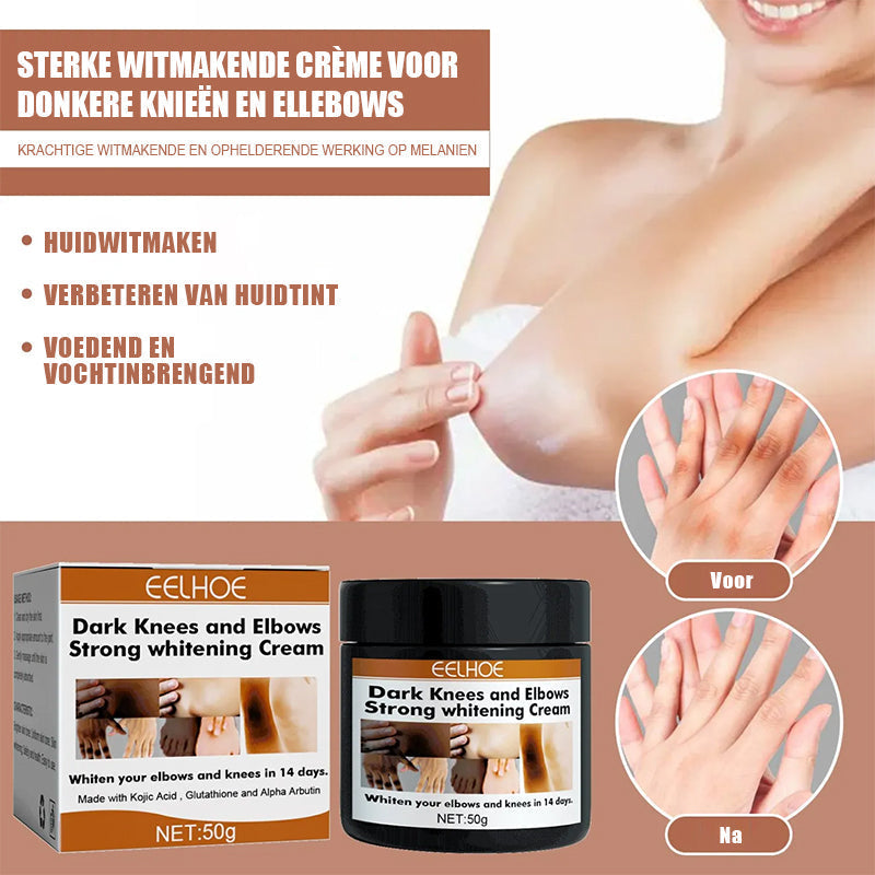Aufhellende Körpercreme für Knie und Ellenbogen