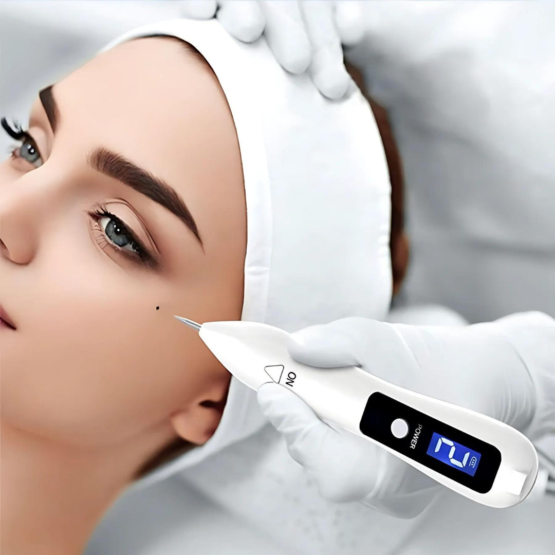 Mole Entferner Stift – Nicht-invasive Plasma-Technologie – Kabellos & Wiederaufladbar – Zu Hause Hauttag & Sommersprossen Behandlung
