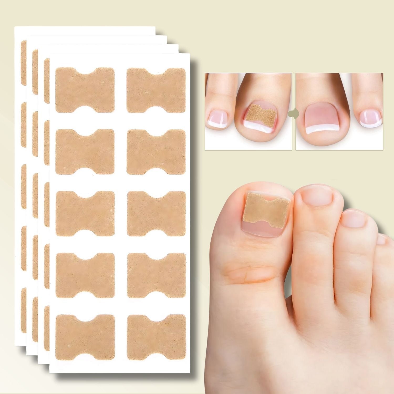 10 Stück + 10 gratis | Sofortige Lösung für Ihre Nagelprobleme