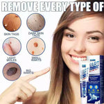 Dermaclear | Warzenentferner-Creme – Schnell & Effektiv