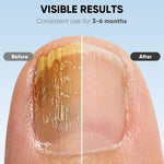 NagelVital – Strong, healthy nails in just 7 minutes a day
