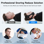 Quiet Nights – Chin Strap for Relaxed Sleep
