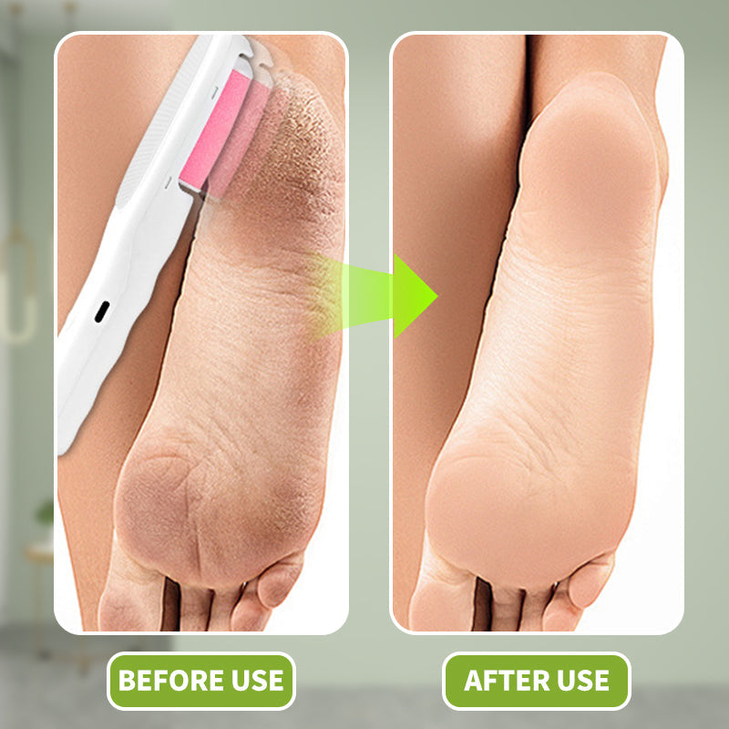 Gentle Skin Care – Smooth feet and hairless skin in no time