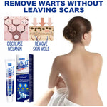 Dermaclear | Warzenentferner-Creme – Schnell & Effektiv