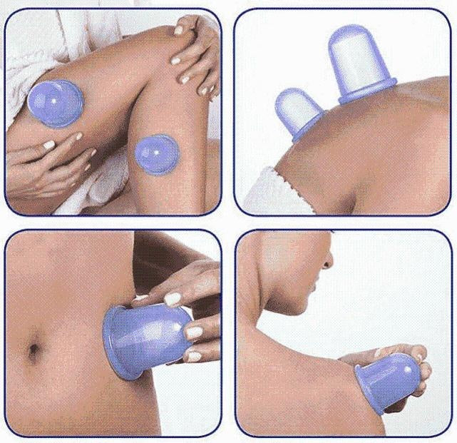 Silikon-Massagebecher zur Hautstraffung | HealthFlex
