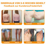 Bienenvenen Gelenkcreme zur Schmerzlinderung