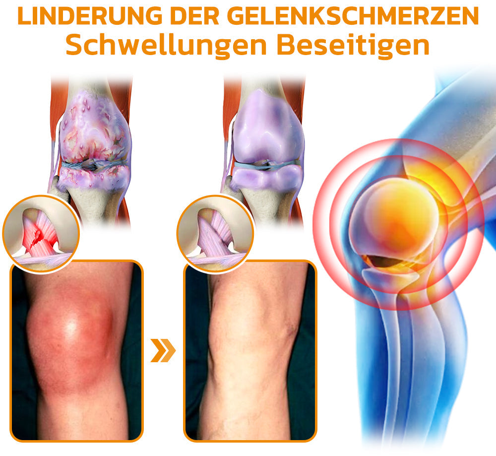 Natürliche Gelenkpflege mit Bienenkraft | ArthroFlex