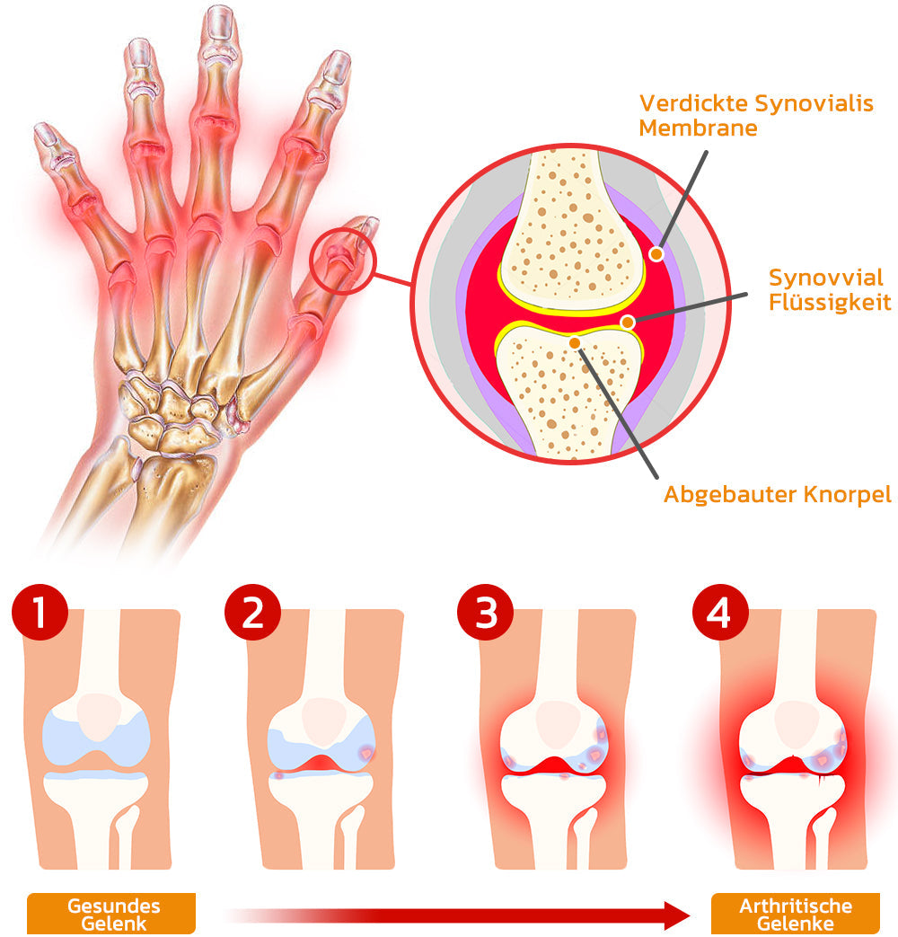 Natürliche Gelenkpflege mit Bienenkraft | ArthroFlex