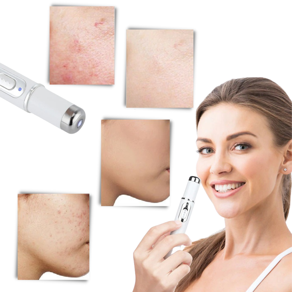 Effective skin therapy device with blue LED lights