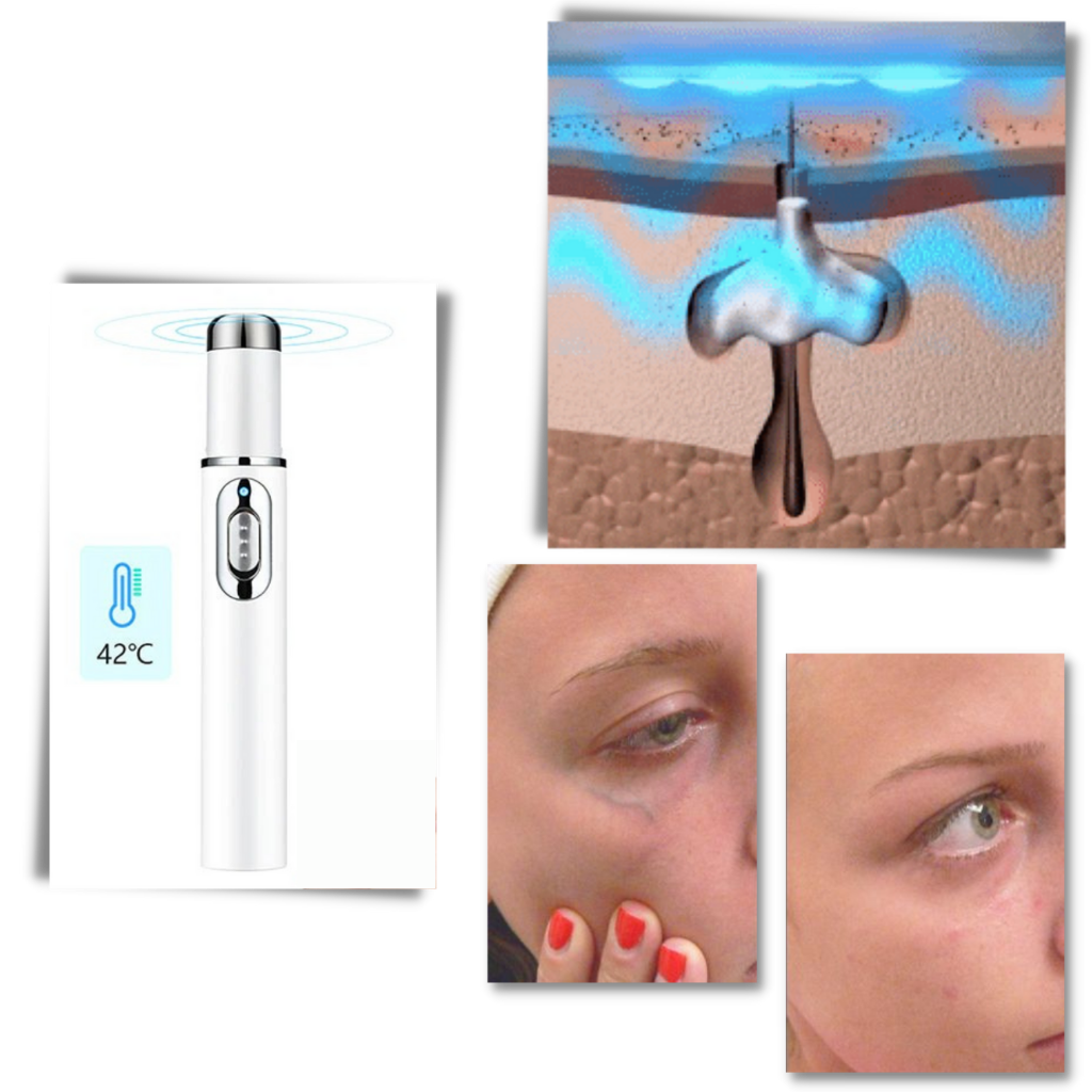 Effective skin therapy device with blue LED lights