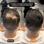 HaarZauber™ | Schnelle Lösung für ein volles, natürliches Haarbild!