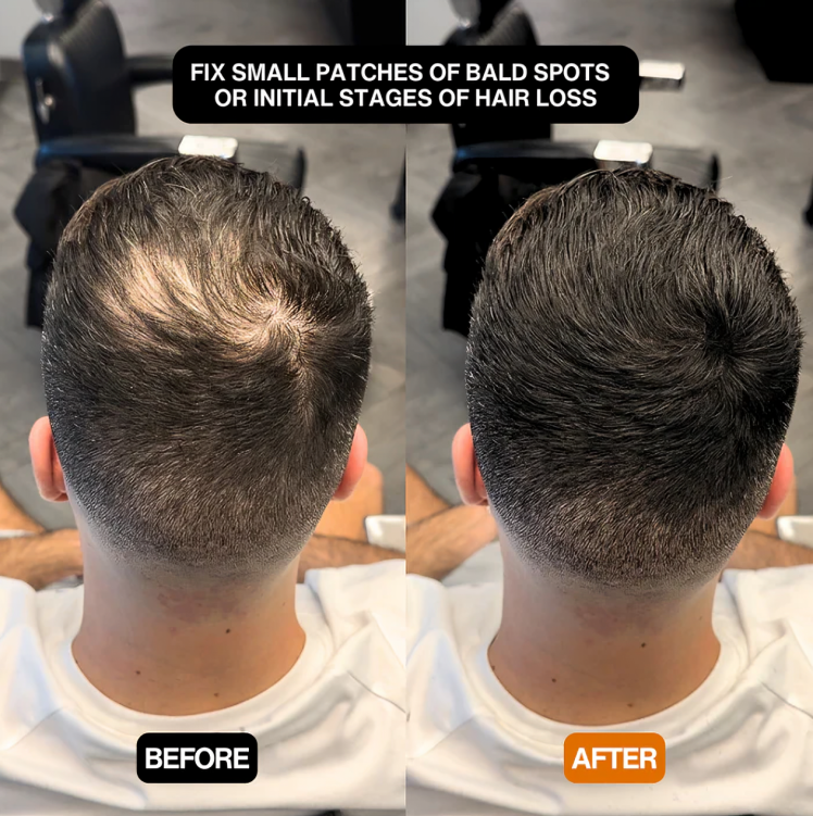 HaarZauber™ | Schnelle Lösung für ein volles, natürliches Haarbild!