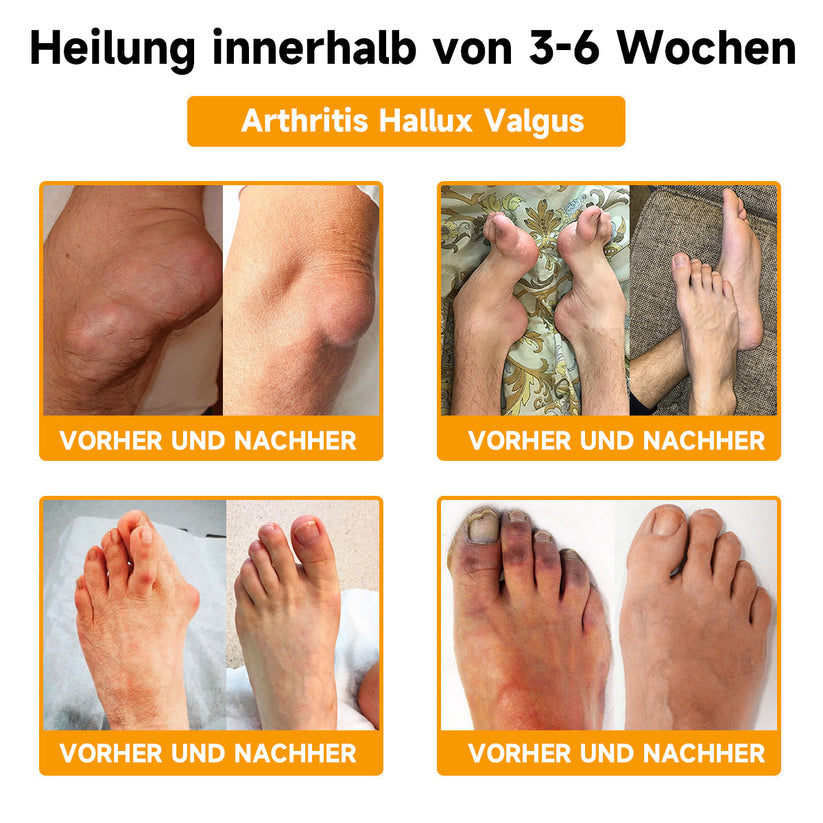 Honigbienen-Creme | Peptide für strahlende Haut | Hyaluronsäure & Kollagen