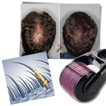 Skin and Beard Care Roller for Optimal Growth