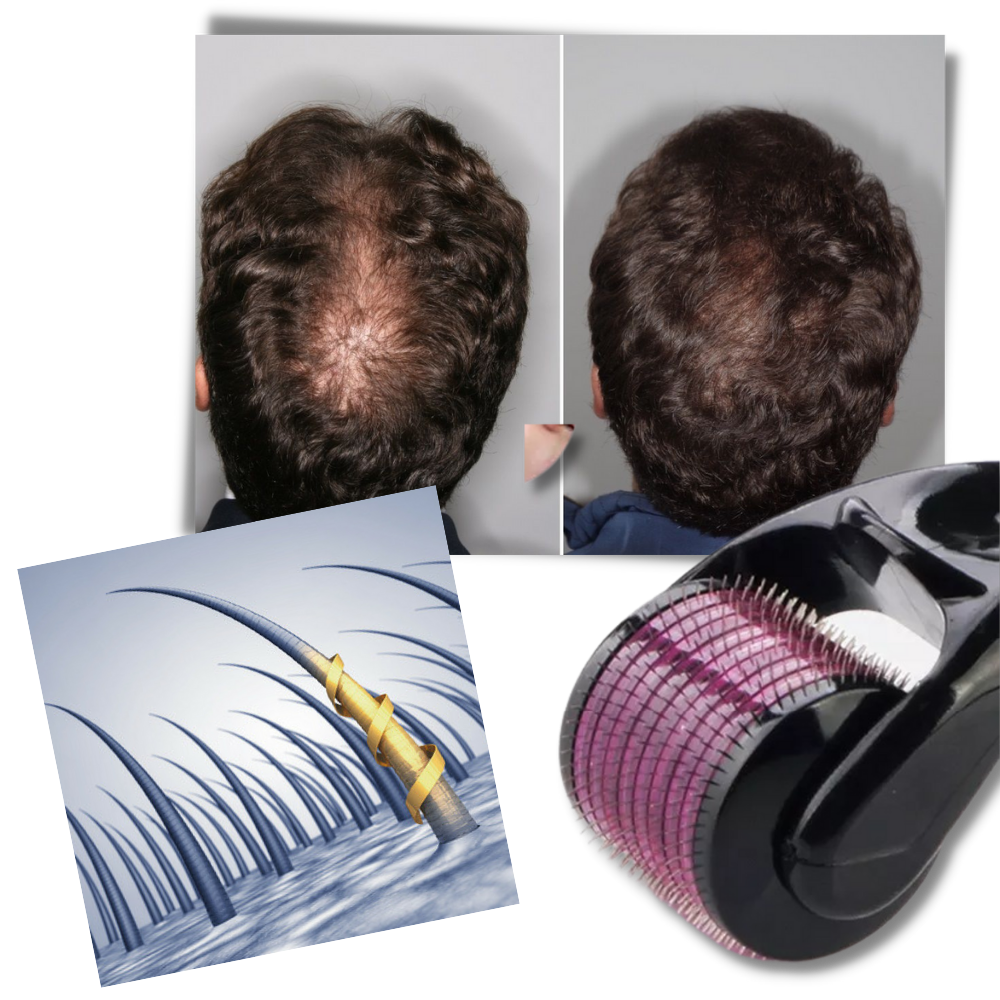 Skin and Beard Care Roller for Optimal Growth