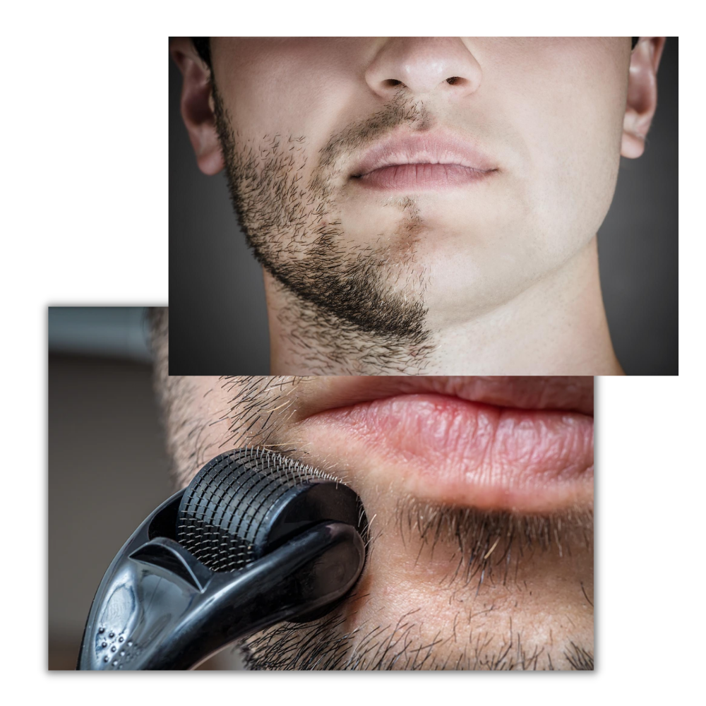 Skin and Beard Care Roller for Optimal Growth