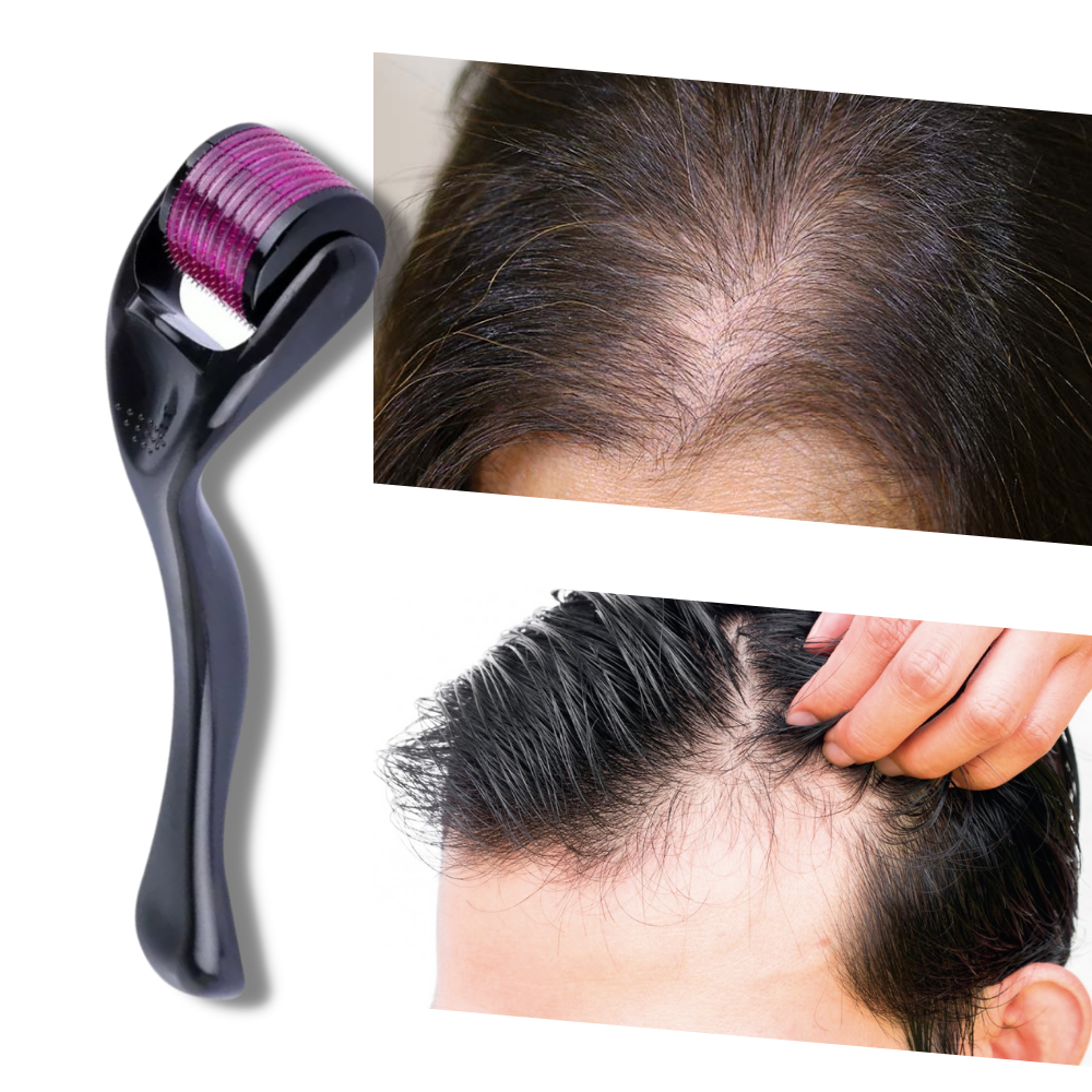 Skin and Beard Care Roller for Optimal Growth