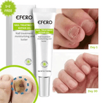 Beautiful nails in no time: 1 + 2 FREE – Limited offer