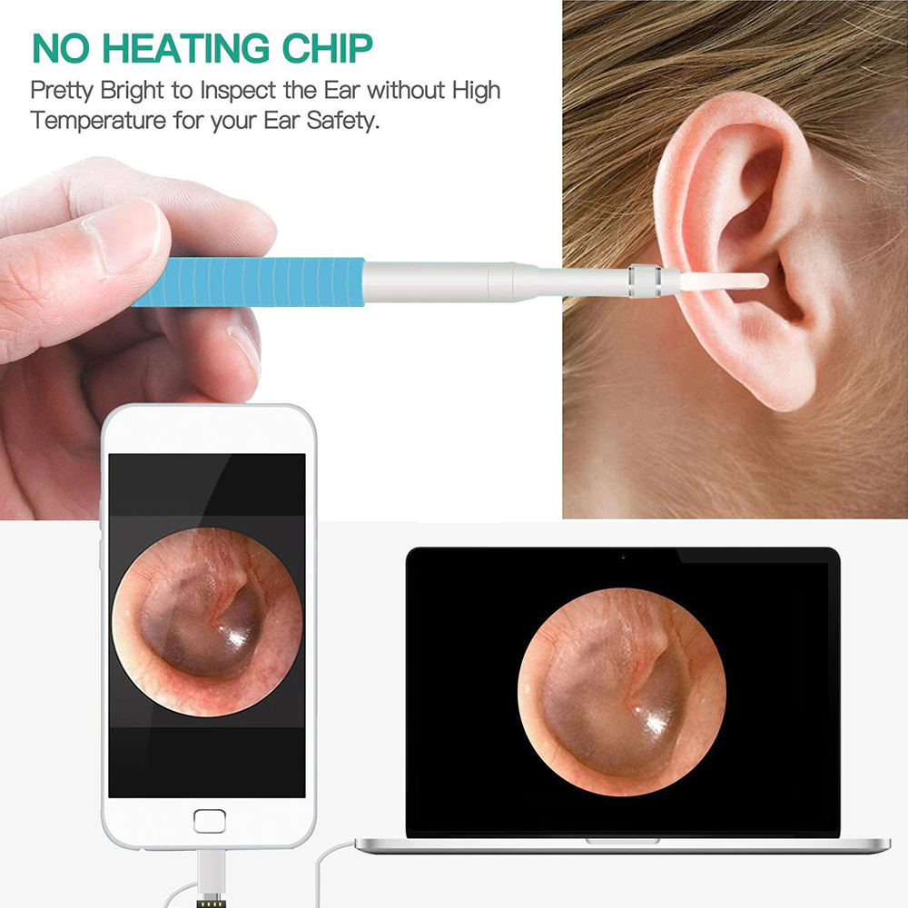 Ear Cleaner | 3-in-1 Ear Cleaning Camera
