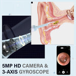 OhrReiniger Pro | Schmerzfreie Ohrreinigung mit HD-Visualisierung!
