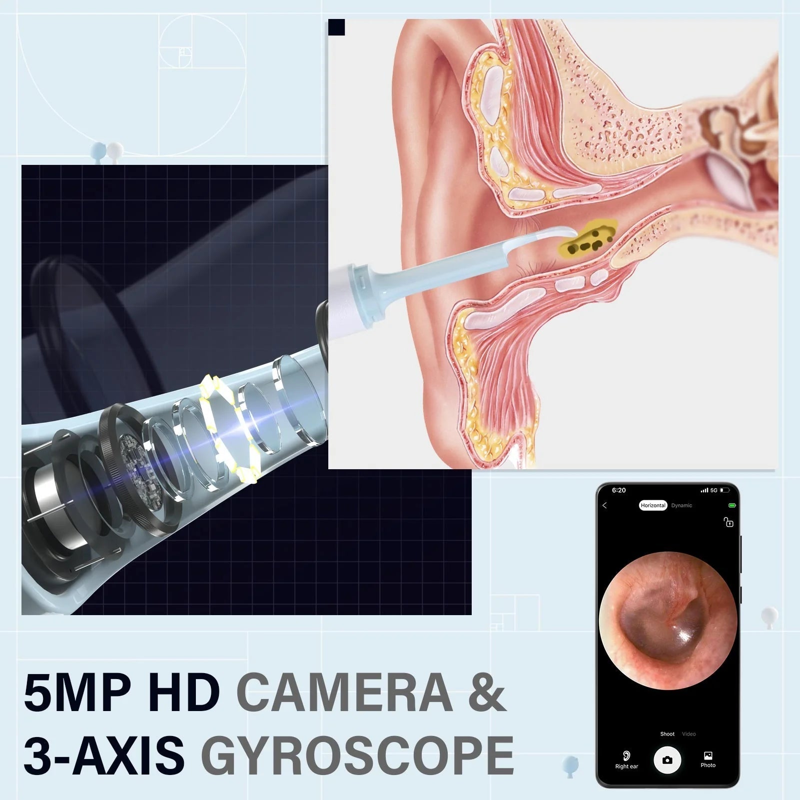 OhrReiniger Pro | Schmerzfreie Ohrreinigung mit HD-Visualisierung!