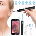 OhrReiniger Pro | Schmerzfreie Ohrreinigung mit HD-Visualisierung!