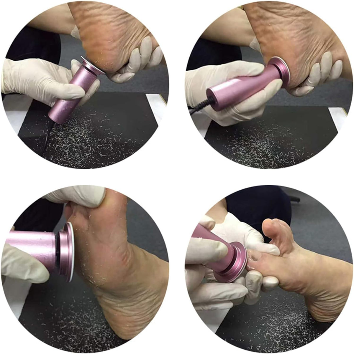 Electric Callus Remover for Well-Groomed Feet