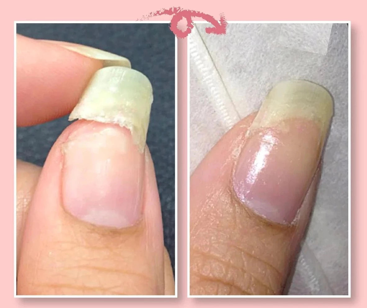 NailProfi – Pflege für Ihre Nägel