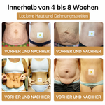 Körperformung leicht gemacht – Schlankheits-Pflaster für Sie