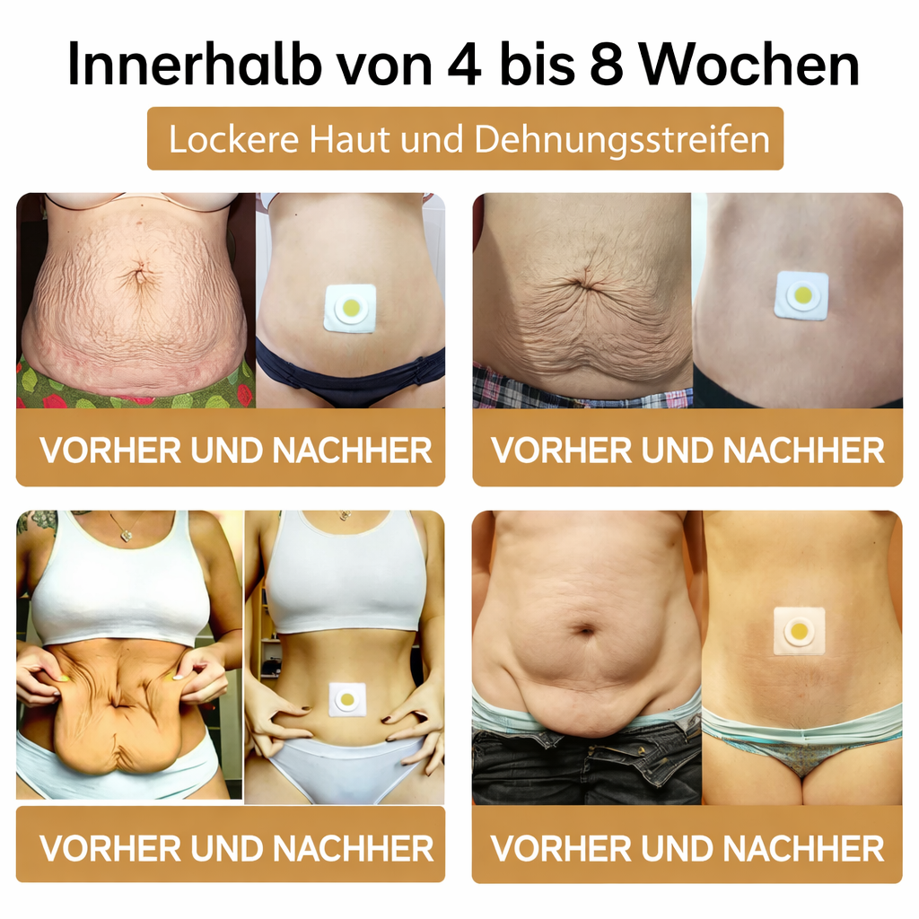 Körperformung leicht gemacht – Schlankheits-Pflaster für Sie