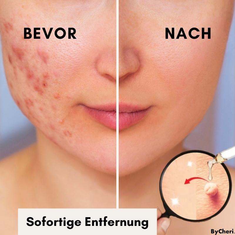 Makellose Hautpflege | Befreie dich von Hautunreinheiten
