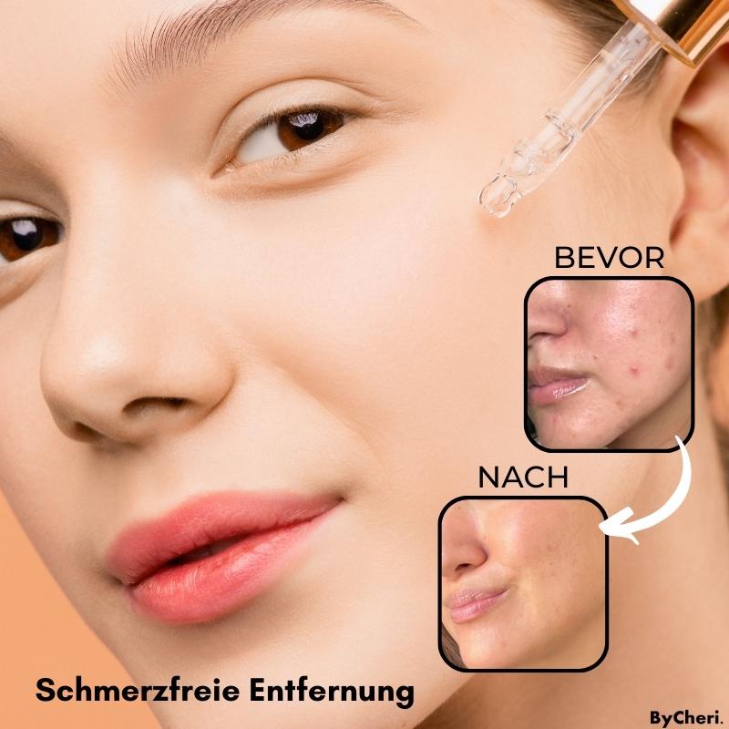 Makellose Hautpflege | Befreie dich von Hautunreinheiten