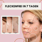 Makellose Hautpflege | Befreie dich von Hautunreinheiten