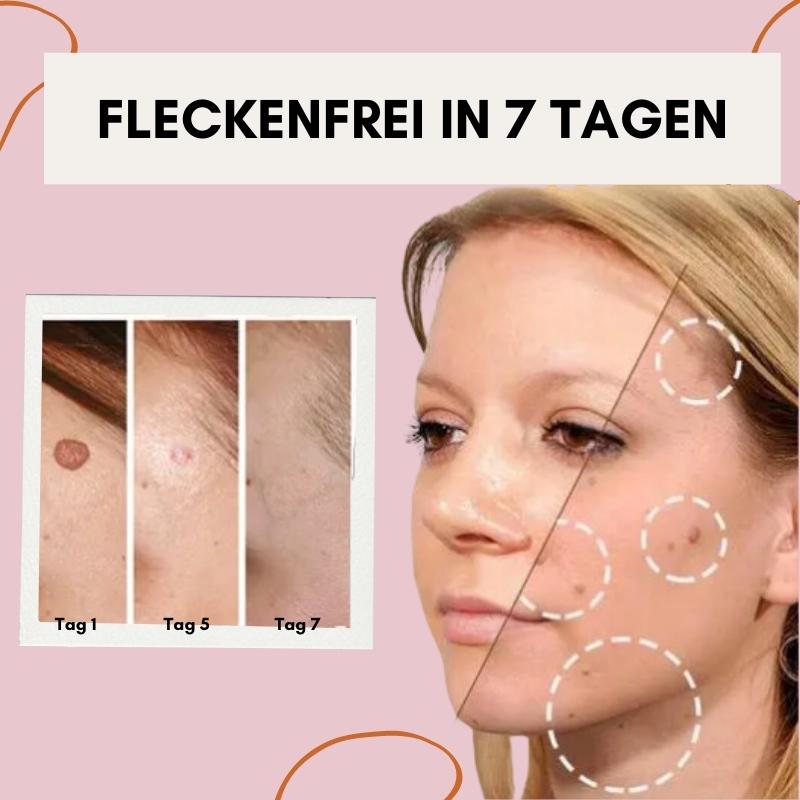 Makellose Hautpflege | Befreie dich von Hautunreinheiten