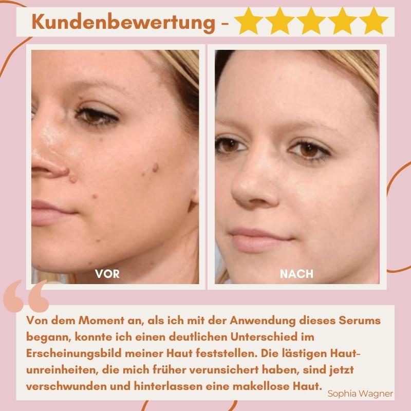 Makellose Hautpflege | Befreie dich von Hautunreinheiten