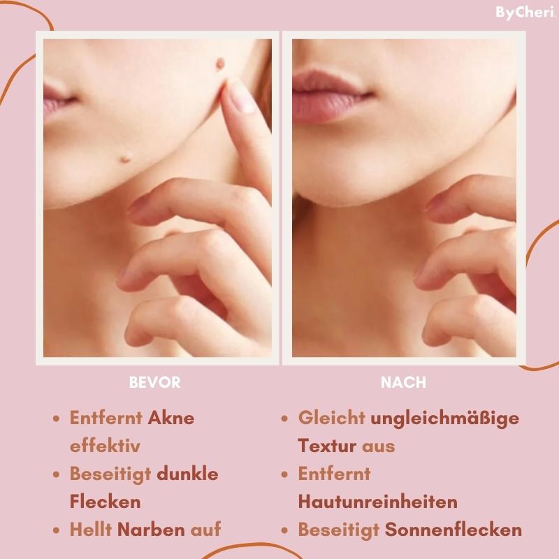 Makellose Hautpflege | Befreie dich von Hautunreinheiten