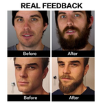 BeardBoost - Alles-in-einem Bartpflegeöl
