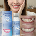 Schnelle Zahnreparatur | Temporäre Zahnprothese | Dentafix