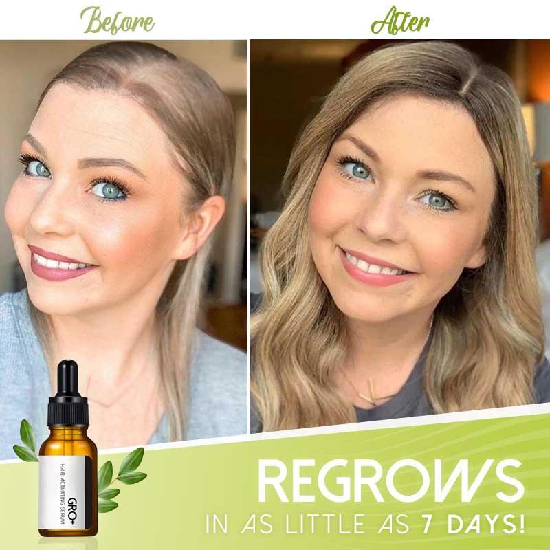 VitalHair Serum – Für volles und kräftiges Haar