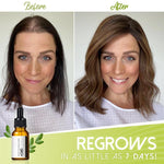 VitalHair Serum – Für volles und kräftiges Haar