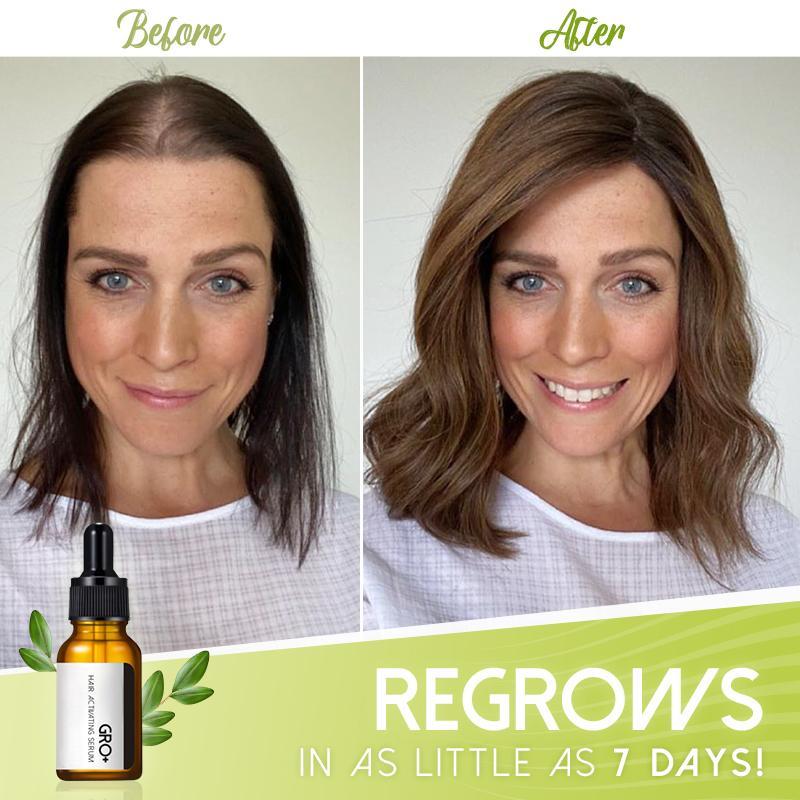 VitalHair Serum – Für volles und kräftiges Haar