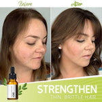 VitalHair Serum – Für volles und kräftiges Haar