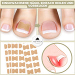 10 Stück + 10 gratis | Sofortige Lösung für Ihre Nagelprobleme