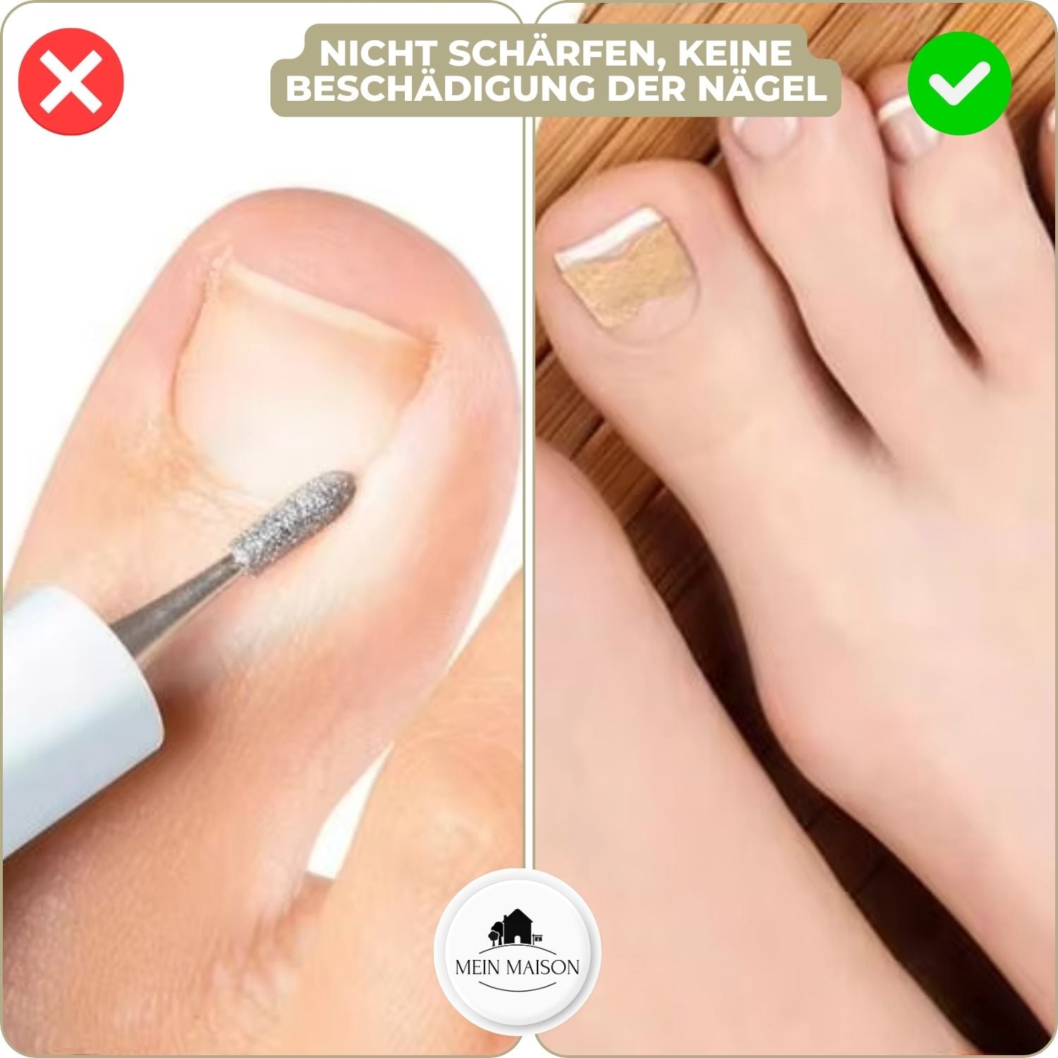 10 Stück + 10 gratis | Sofortige Lösung für Ihre Nagelprobleme