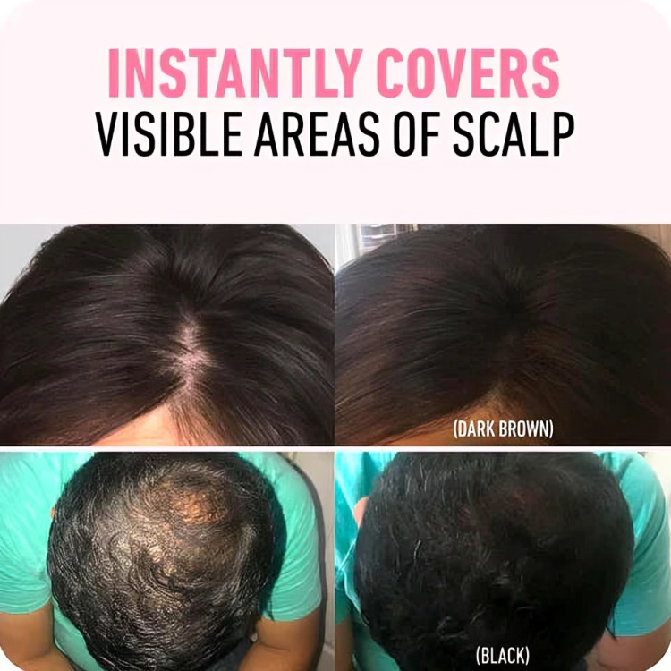 Graue Haare? Unser Haarpuder löst das Problem sofort!