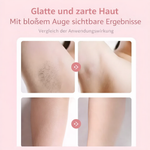 Effiziente Haarentfernung für Frauen | Schmerzfreies Präzisionsrasieren | GlattGleiten