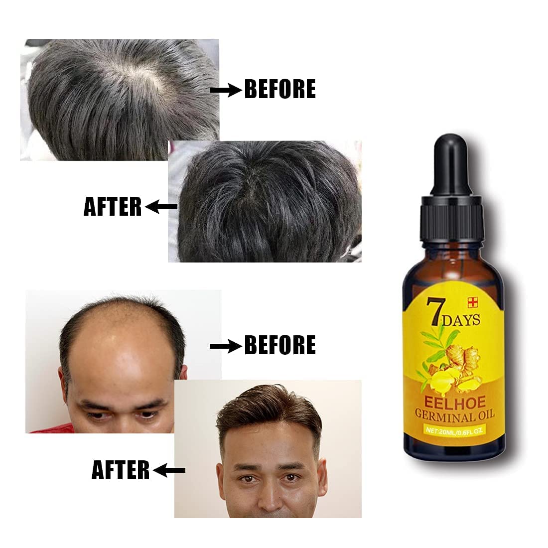 Haarwuchs Booster | Kopfhautpflege Serum für Stärkung