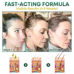 HaarVital™ - Fülligeres Haar auf natürliche Weise