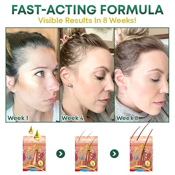 HaarVital™ - Fülligeres Haar auf natürliche Weise